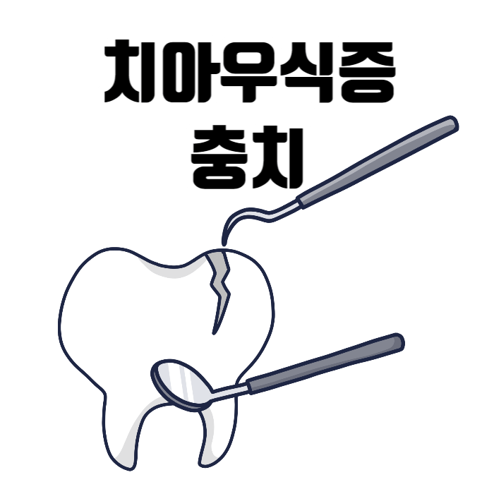 치아우식증 충치