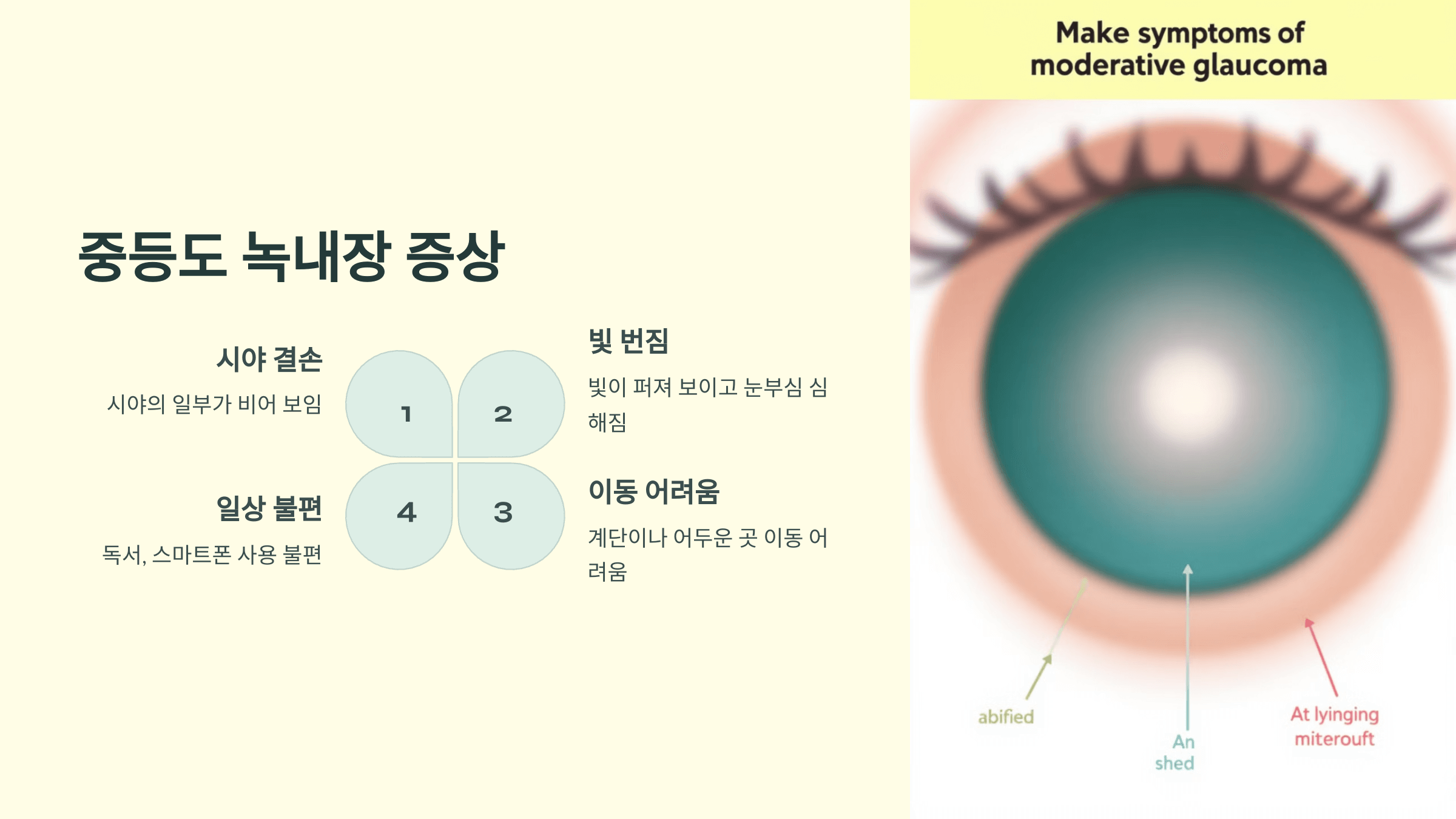 ㅍ