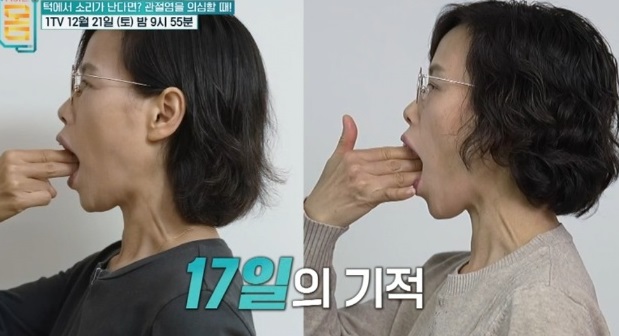 17일의기적