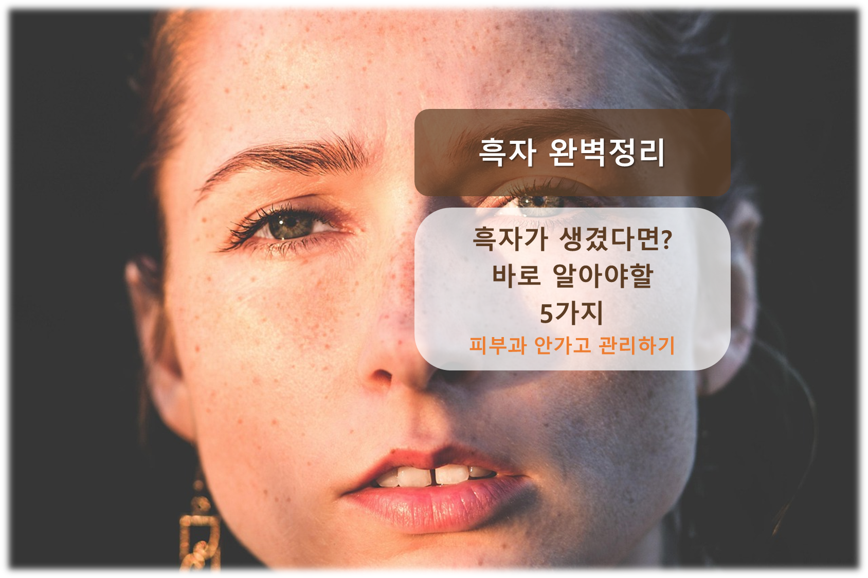흑자 관리