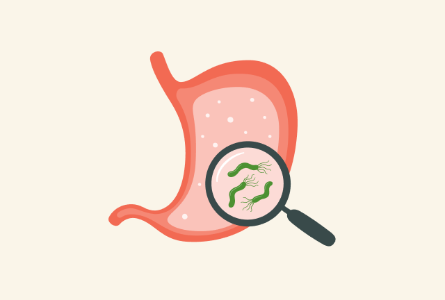 헬리코박터균 관련 사진