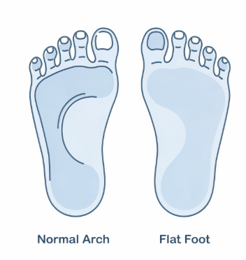 족저 근막염 증상
