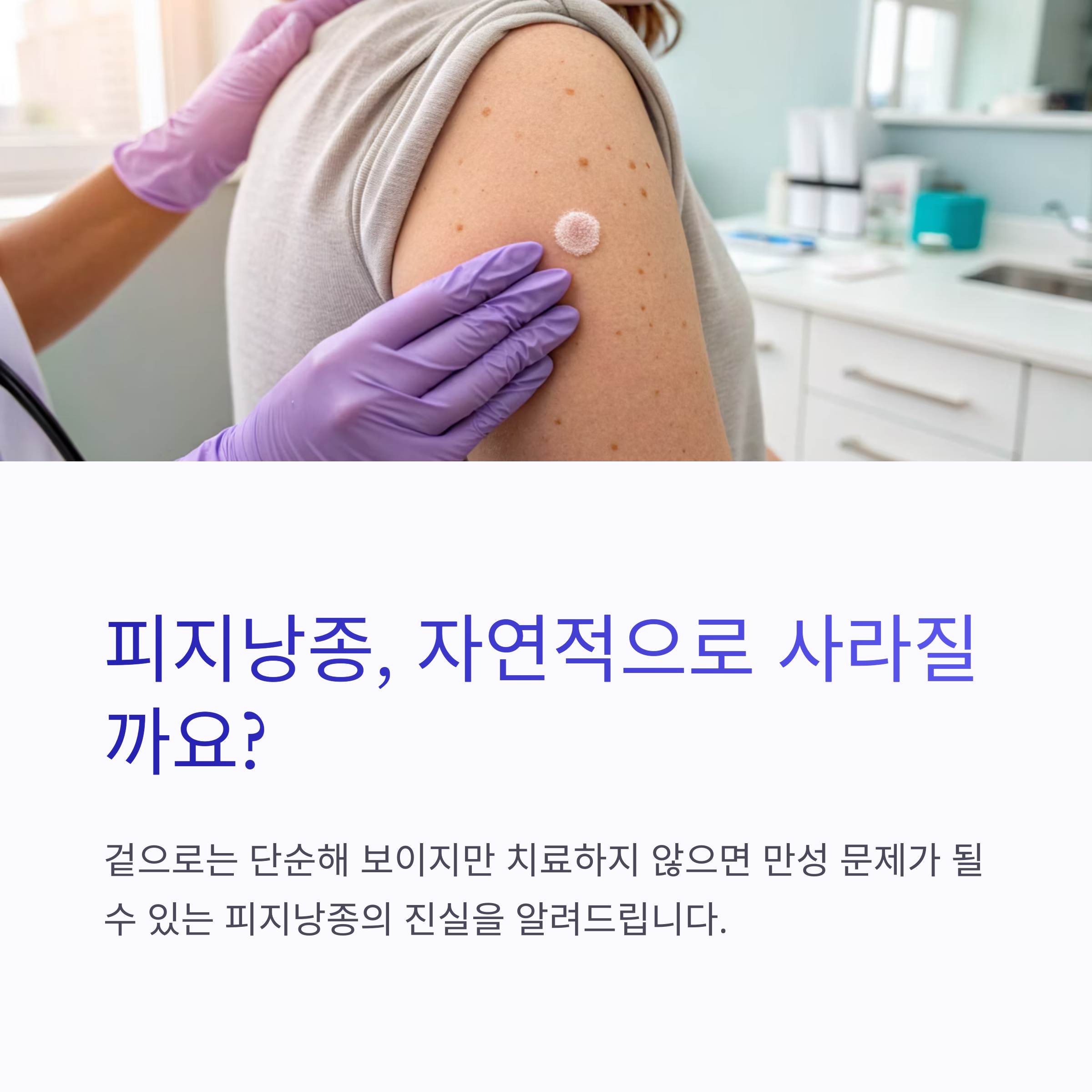피지낭종