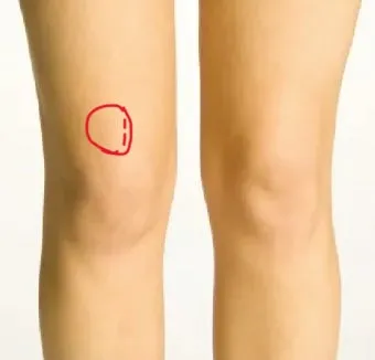 무릎 통증 원인 치료방법 치료약으로_19