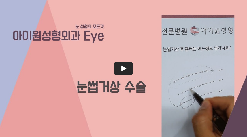 아이원성형외과 눈썹거상 수술 설명