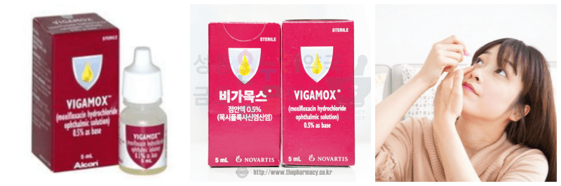 비가목스점안액, 안약 넣는 사진