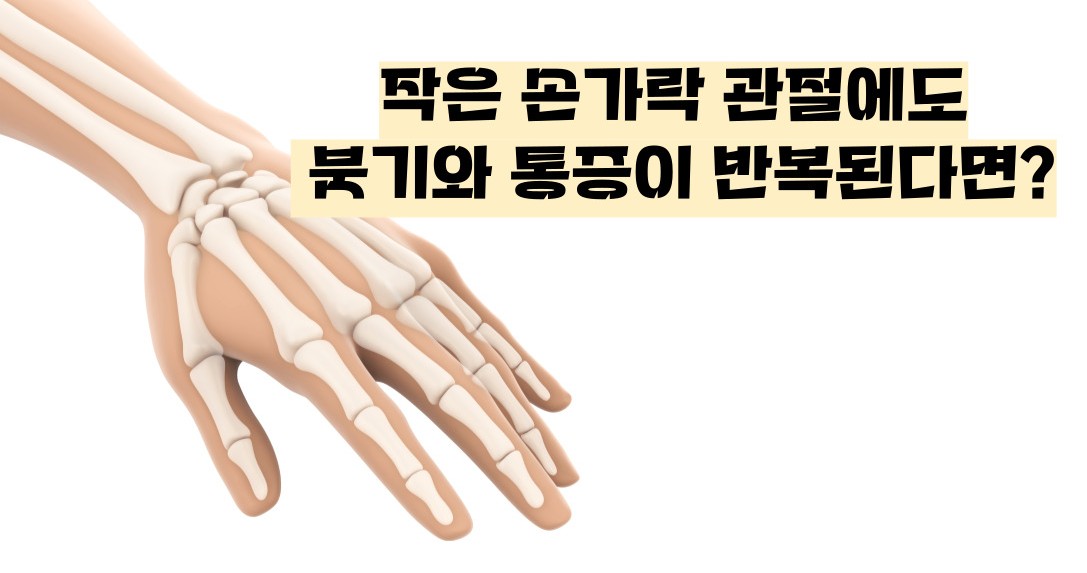 류마티스 관절염 초기증상