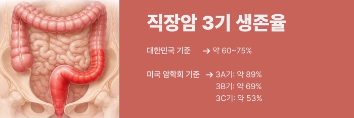 직장암 3기 생존율