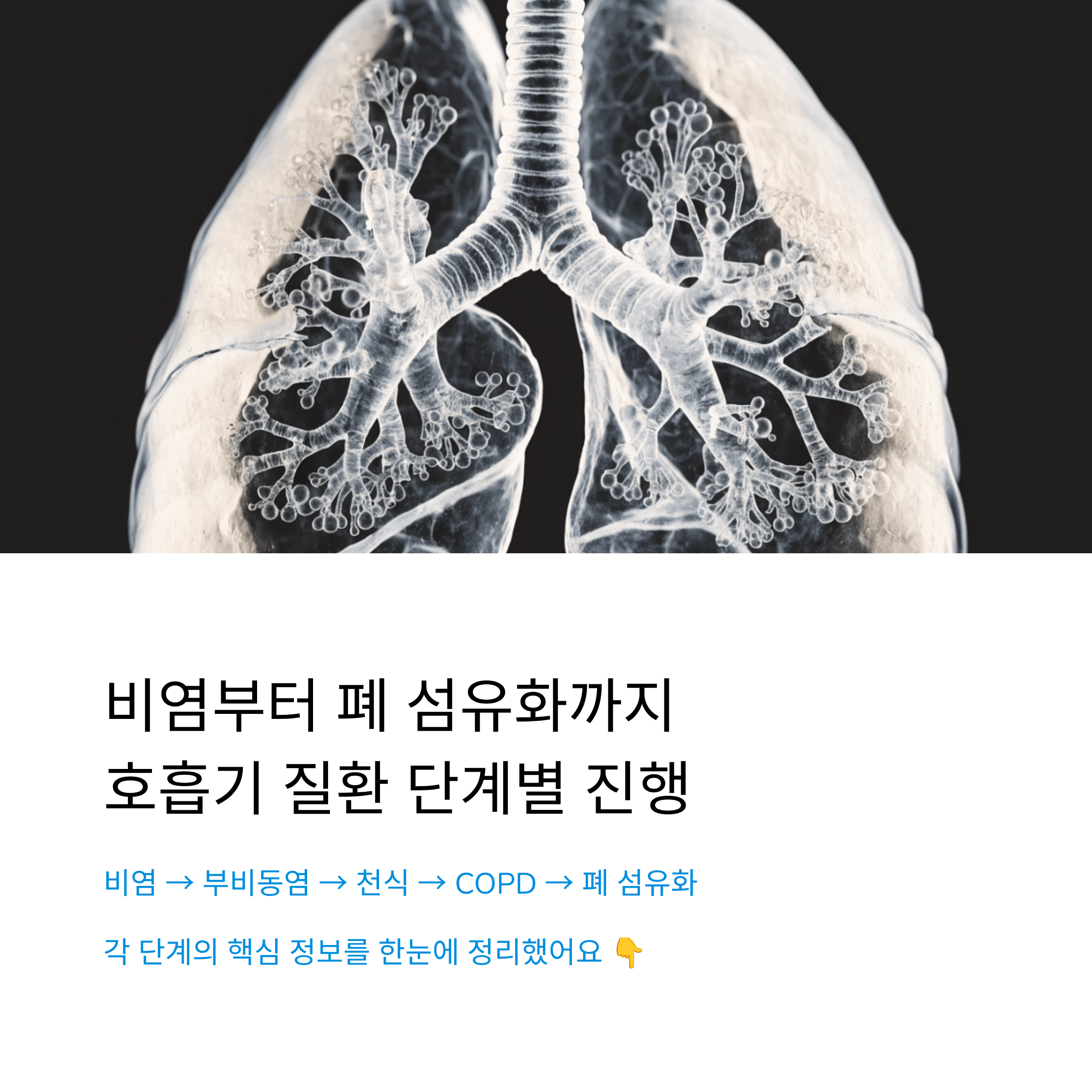 비염 부비동염 천식 COPD 폐 섬유화까지 호흡기 질환 단계별 진행 과정과 핵심 정보 총정리