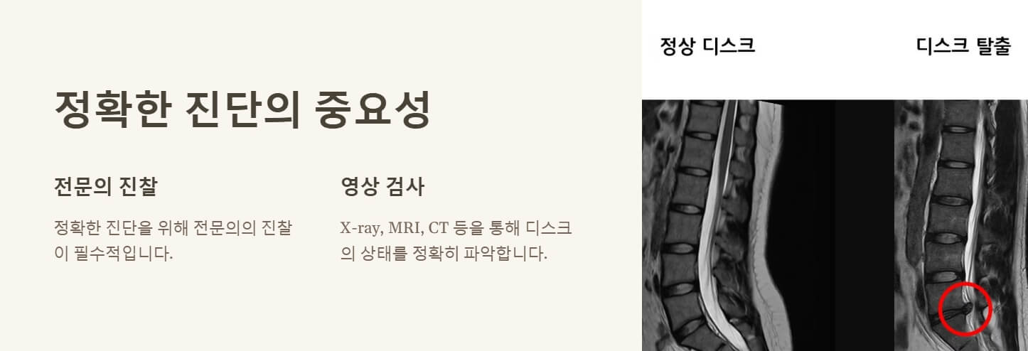 허리디스크 다리저림 및 치료법