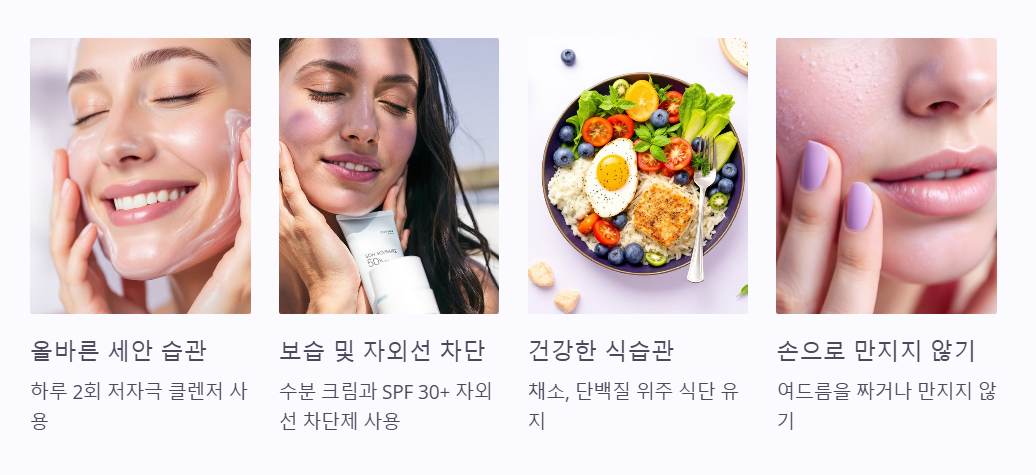 화농성 여드름 예방법
