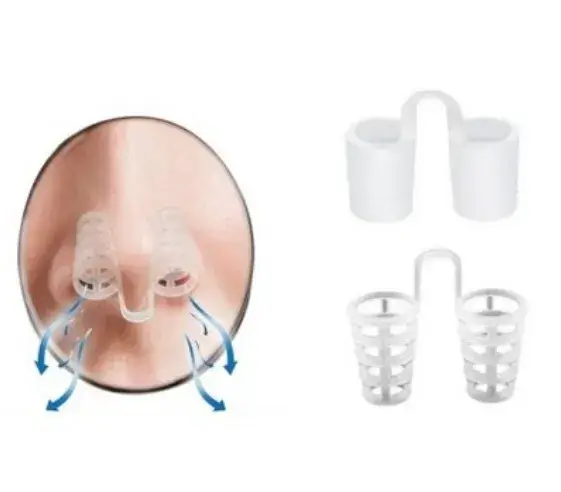 수면 무호흡증 치료 기구(비강확장기)