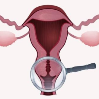 자궁 경부 위치