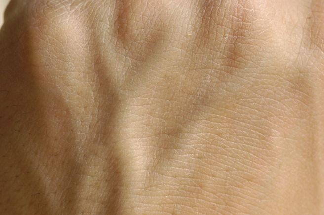 손등에 힘줄이 튀어나오는 이유