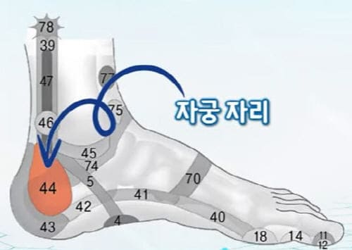 자궁자리