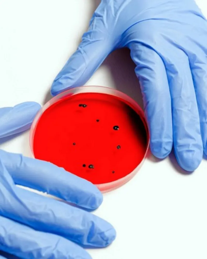 B형 독감 잠복기