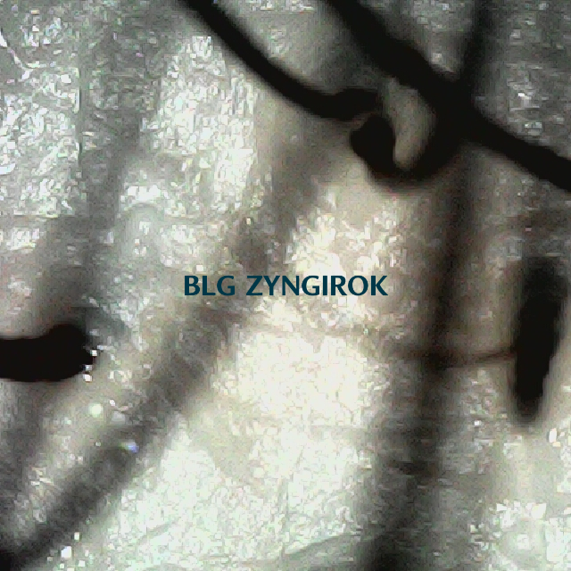 탈모 극복 프로젝트 - 뒷머리 두피 모습이다.