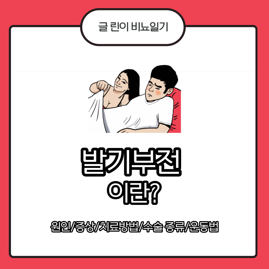 발기부전
