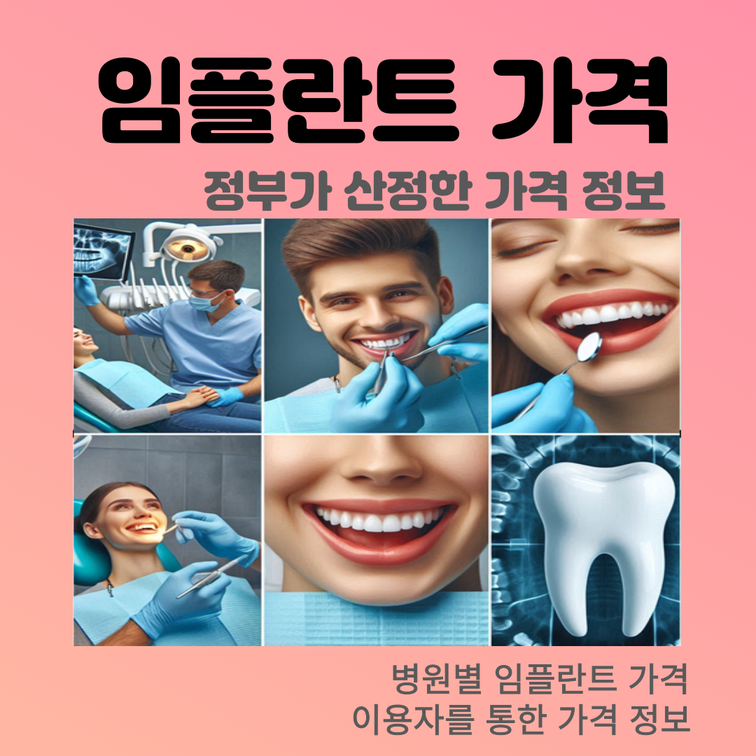 임플란트 가격 정보