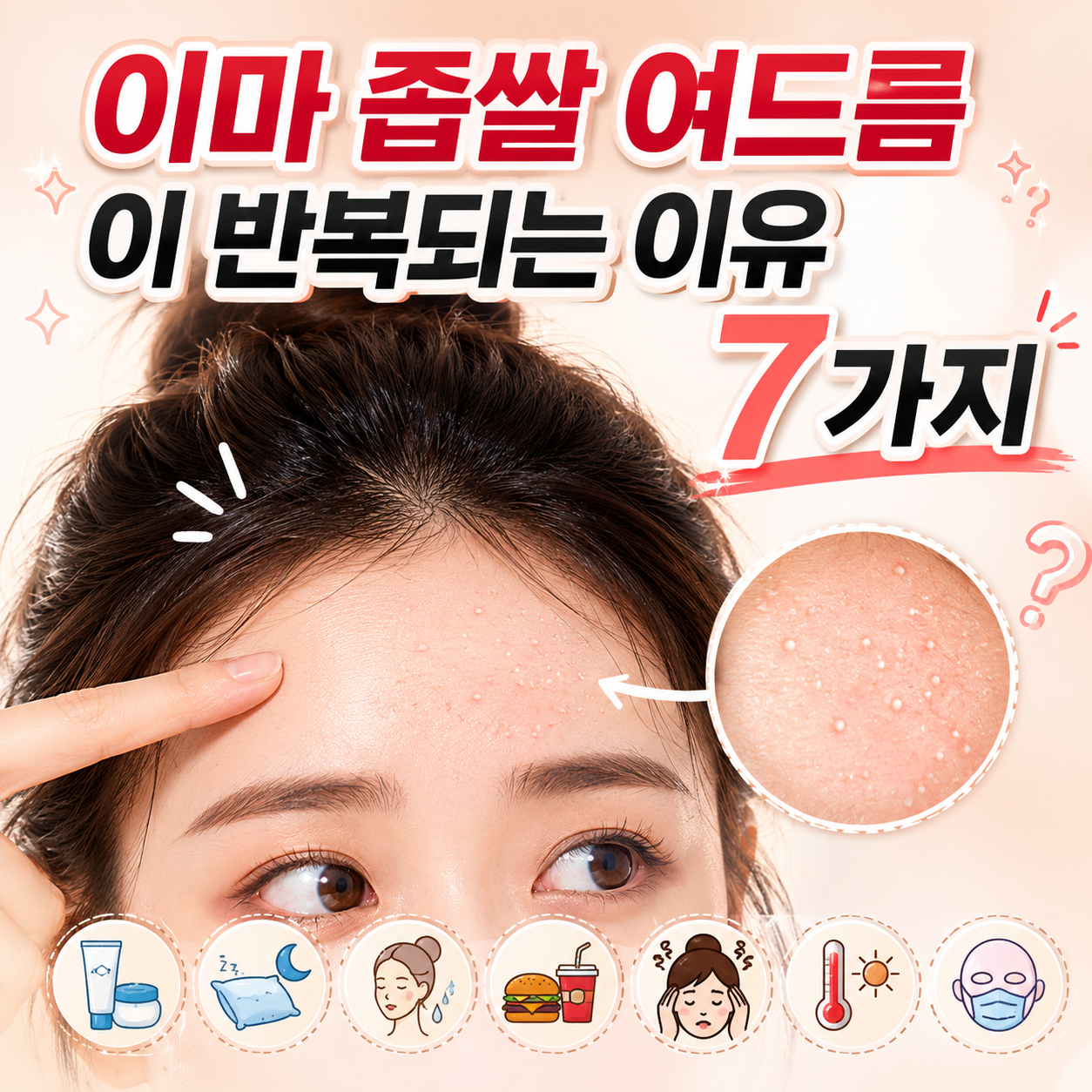이마 좁쌀 여드름