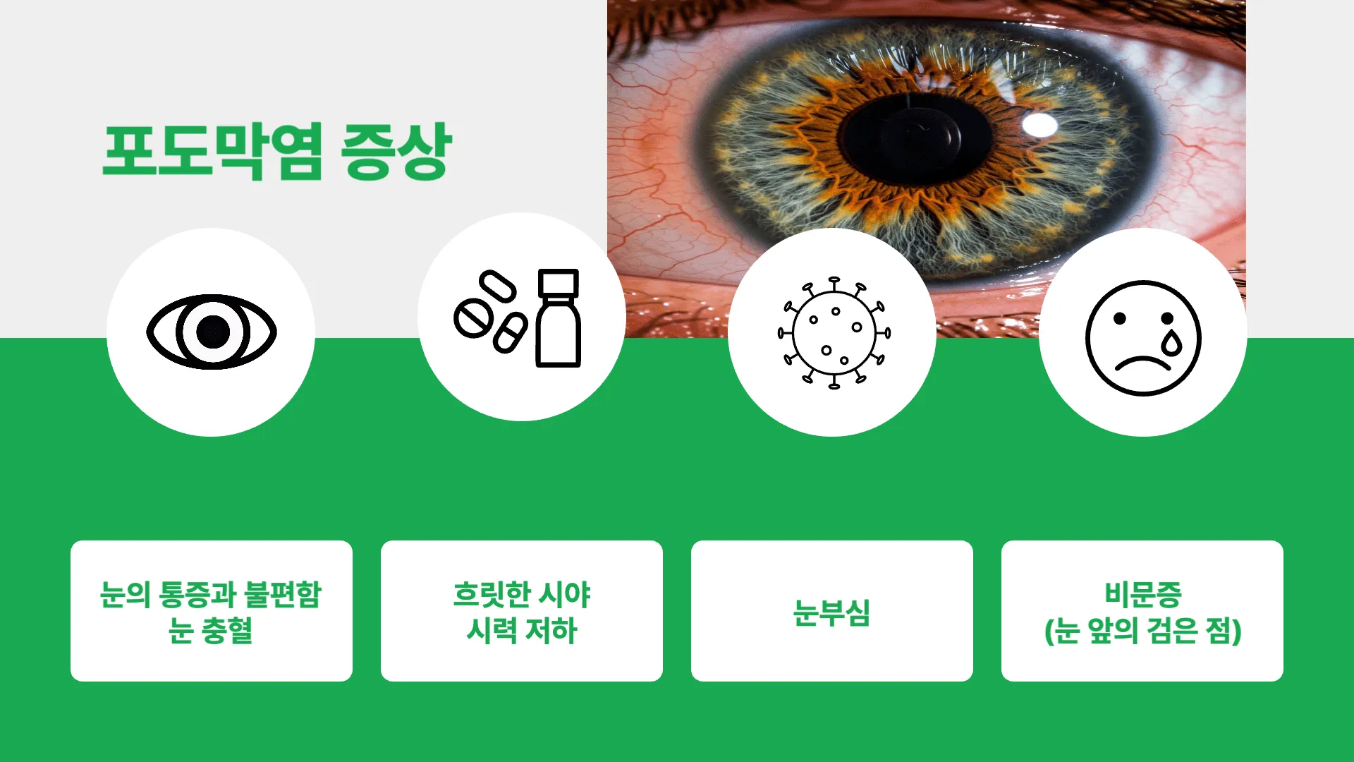 포도막염의 대표적인 증상은 무엇인가요?