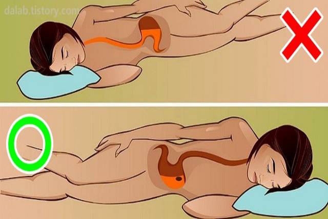 과식했을때 왼쪽으로 누우면 소화 잘되는 이유 과식 후 대처 위식도역류