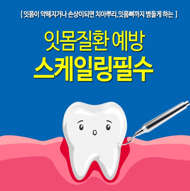 치아 스케일링 관련 사진