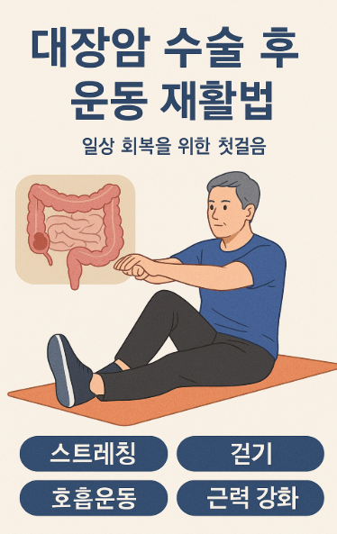 대장암 수술 수 운동 재활법