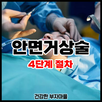 안면거상술