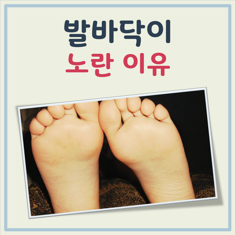 발바닥이 노란이유