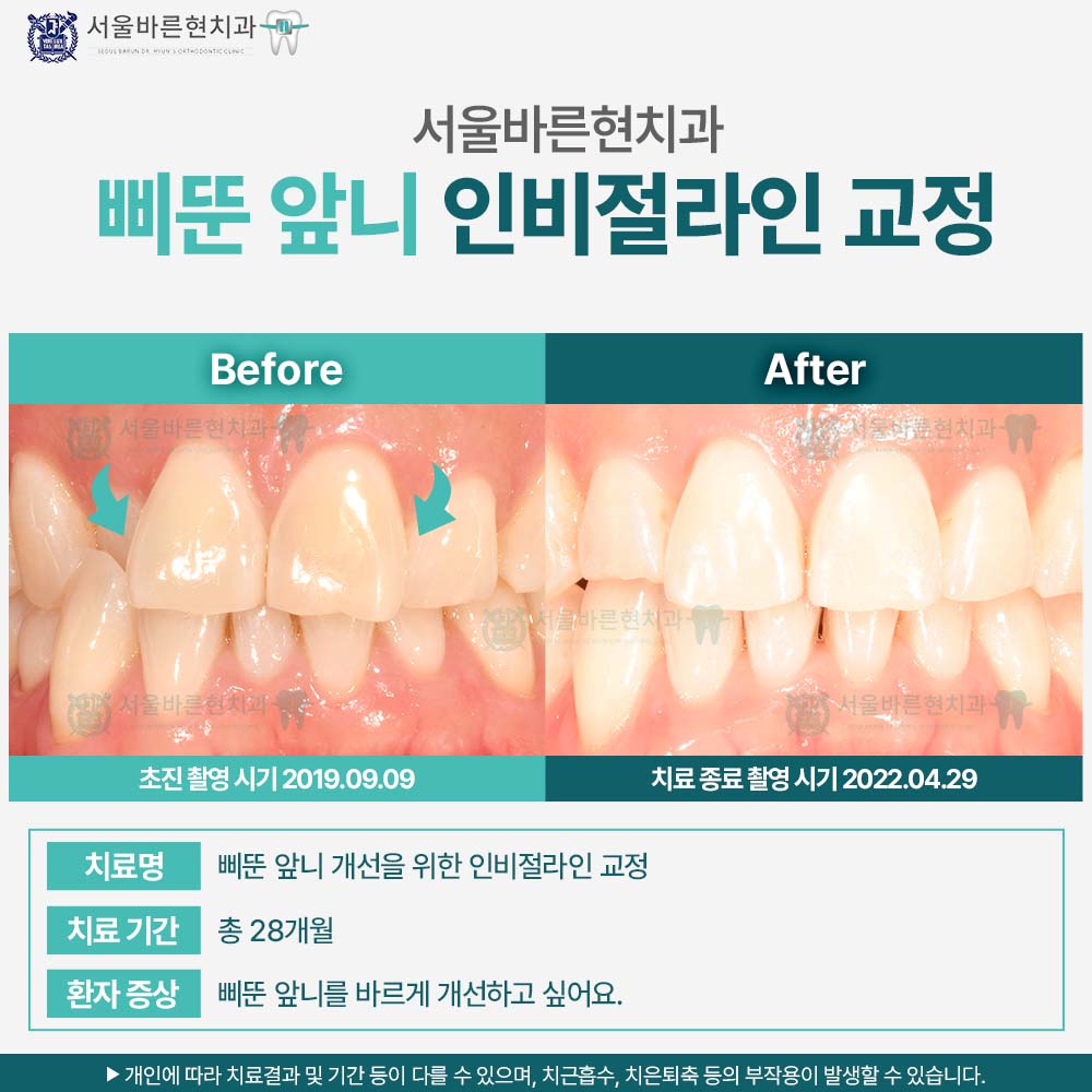 해운대인비절라인