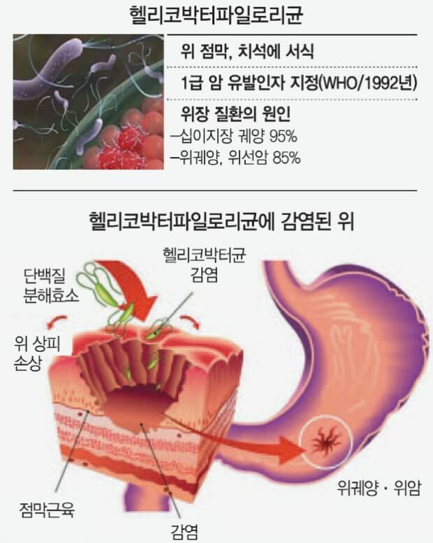 헬리고박터균 질환