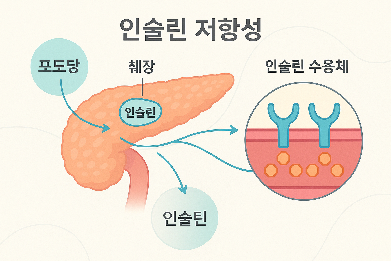 스트레스와 수면 부족이 혈당에 미치는 영향 다이어그램