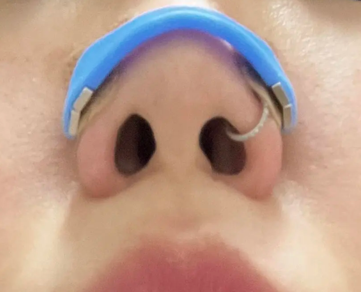 필렉스 노즈 밴드 코골이 방지