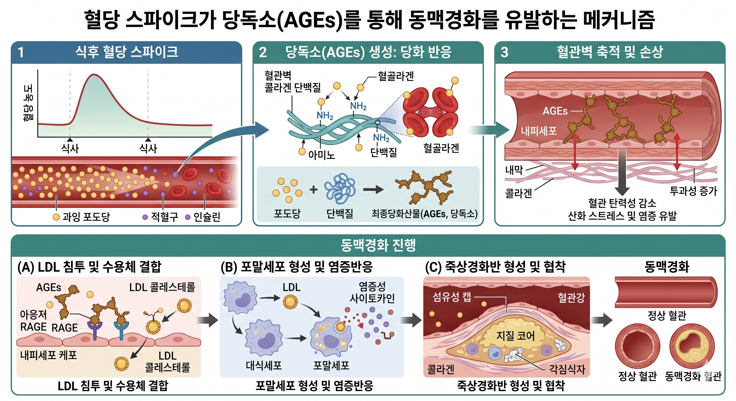 혈당 스파이크로 생긴 당독소가 혈관벽에 쌓여 동맥경화를 일으키는 메커니즘 시각화.
이미지출처: Gemini AI 생성