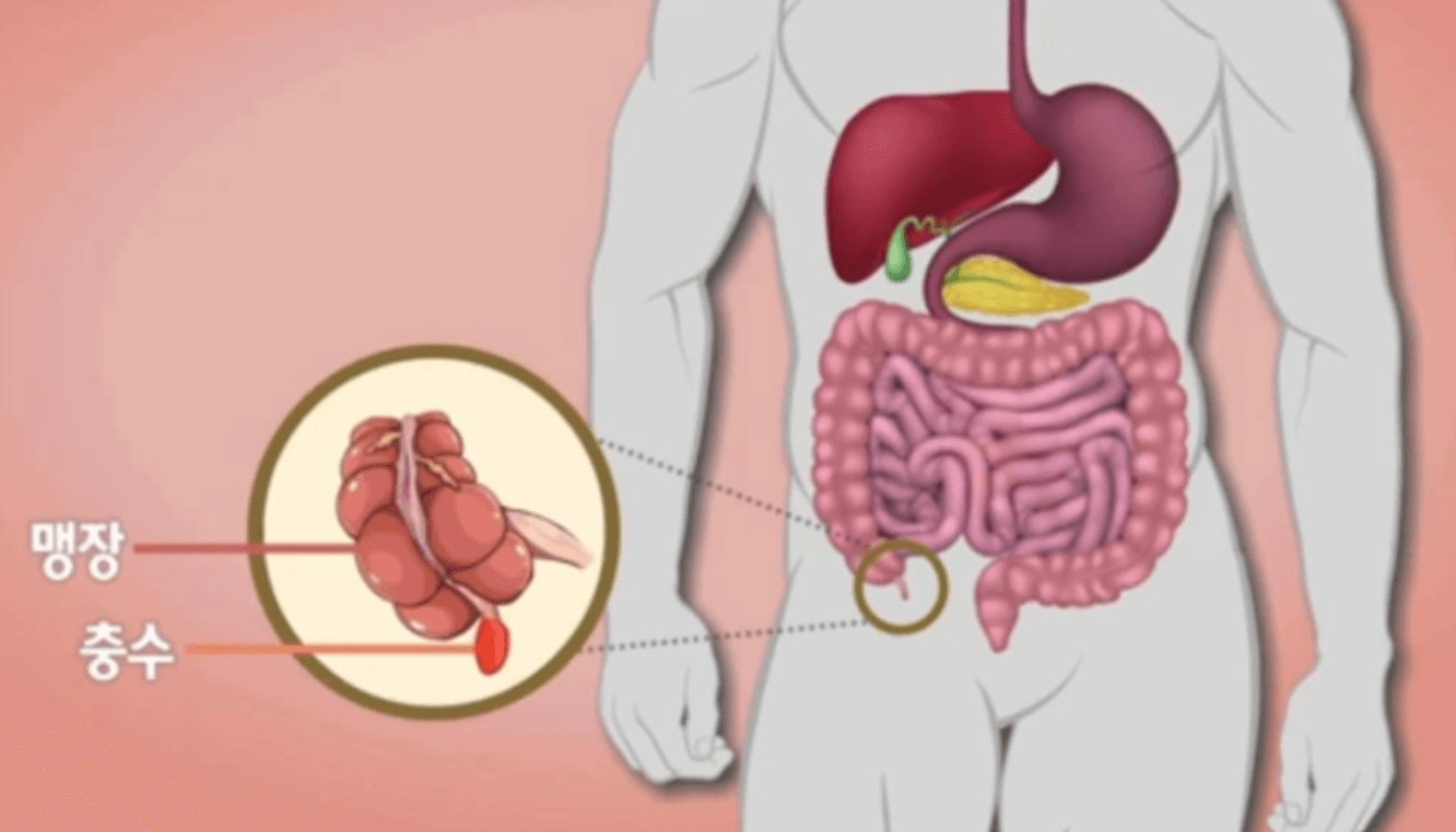 오른쪽 옆구리 통증 맹장염