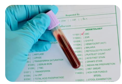 혈액검사 종류