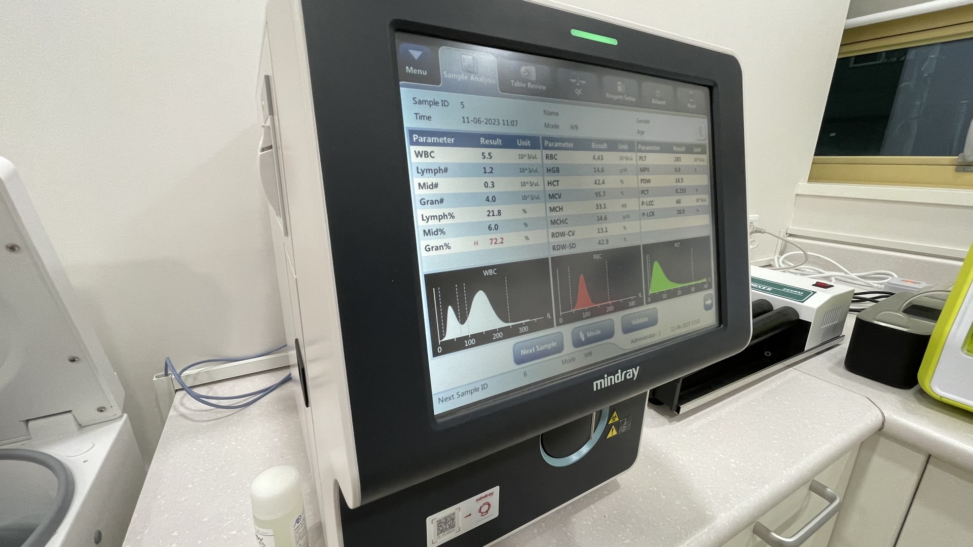 나득영심혈내과 검사장비