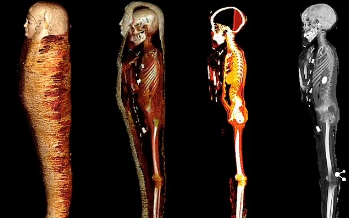 2,300년 전 이집트 '골든 보이' 미이라의 해부 VIDEO: Meet the 'Golden Boy' mummy