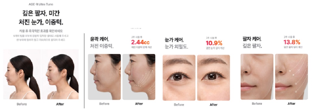 메디큐브-울트라튠-압도적인-콜라겐-생성-디바이스