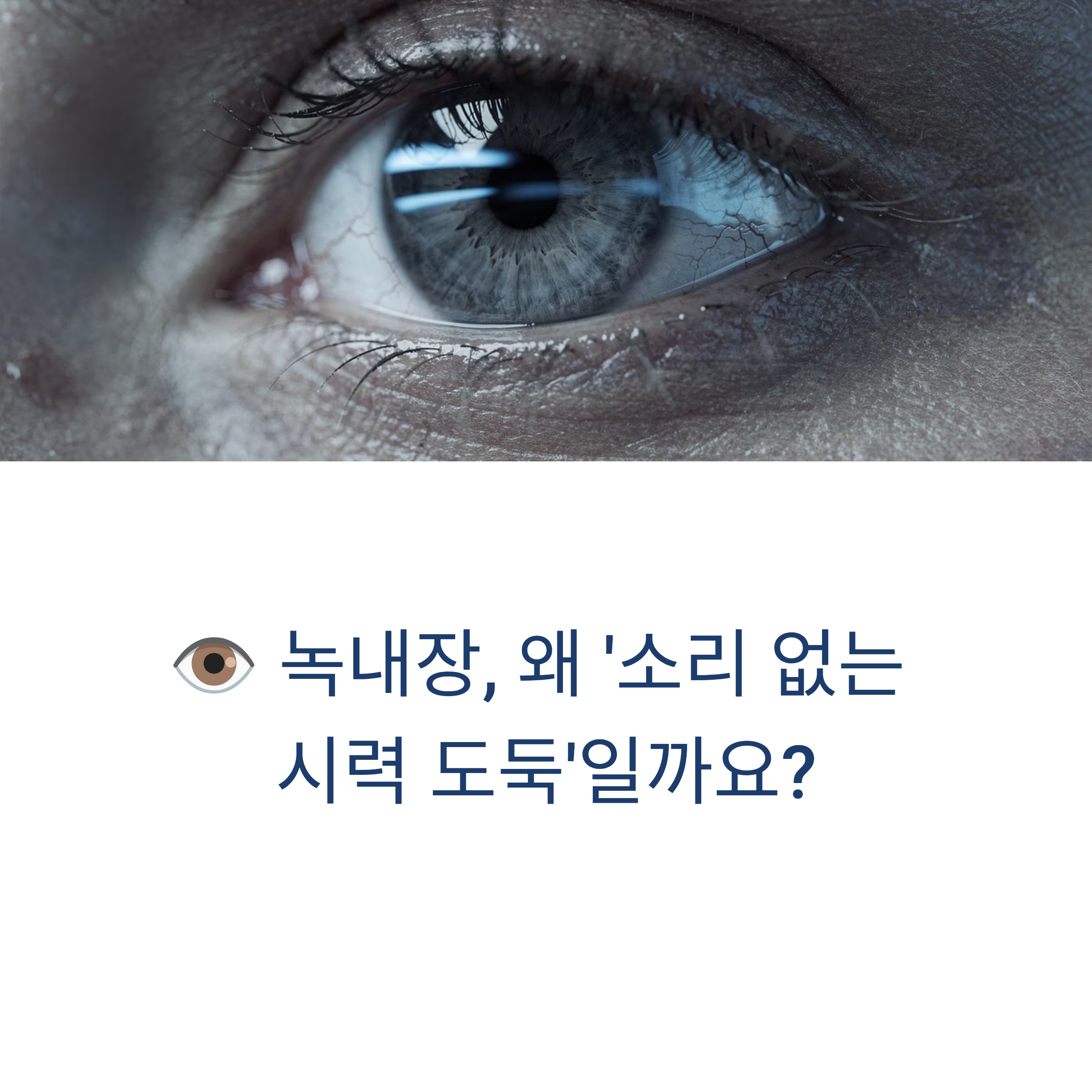 소리 없는 시력 도둑

 소리 없는 시력 도둑 녹내장