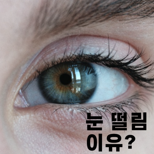눈떨림 이유 : 눈 떨림현상