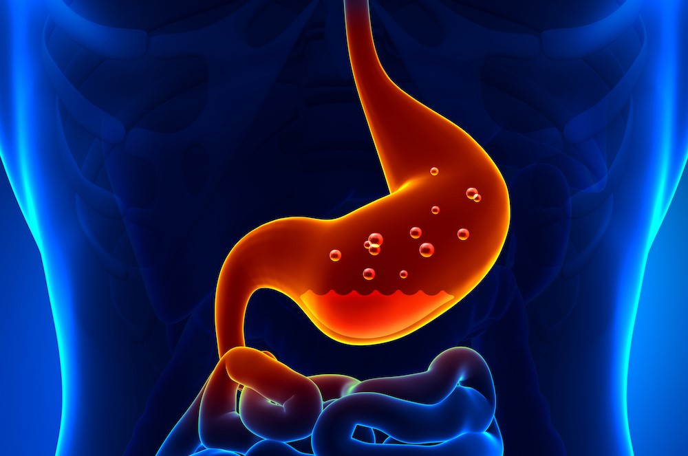 역류성 식도염 증상 원인