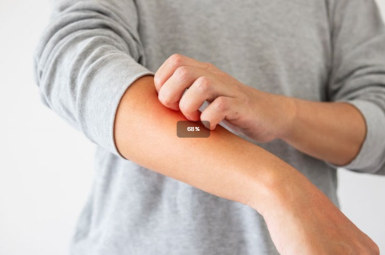 담도암 증상 및 진단 과정 