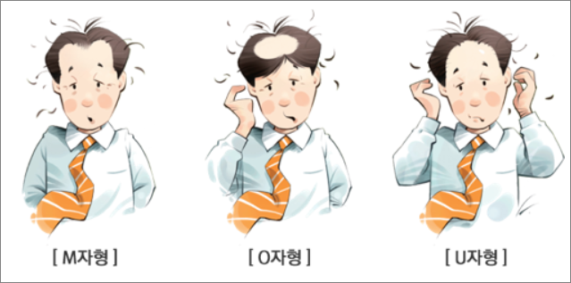 확산성 탈모