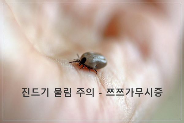 진드기 물림 주의 -진드기