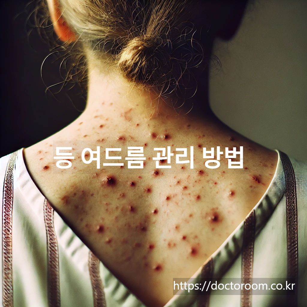 등여드름 관리방법