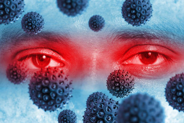 결막염 음식 결막염 증상 결막염 전염 결막염 치료 결막염 안약 결막염 원인 알레르기성 결막염 결막염 치료기간 결막염 약 결막염 전염성 결막염 유행 알레르기 결막염 유행성 결막염