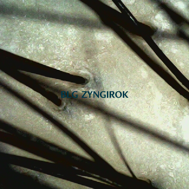 피나모아 복용 13주차 두피 사진 - 정수리 위치 모습이다.