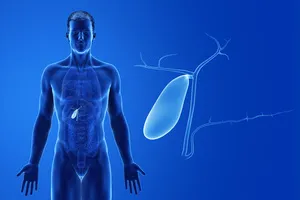 담낭-용종-증상